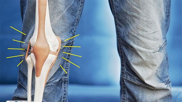 dolor en la articulación de la rodilla