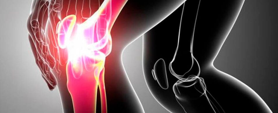 dolor en las articulaciones de la rodilla foto 4