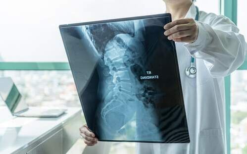 La radiografía es un método de diagnóstico necesario si duele la espalda. 